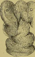 An illustration from Clinical diagnosis : the bacteriological, chemical, and microscopical evidence of disease / By Dr. Rudolf v. Jaksch, ... Translated from the third German edition and enlarged by James Cagney, ... With numerous illustrations (partly in colours). (1893)
