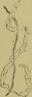 An illustration from Clinical diagnosis : the bacteriological, chemical, and microscopical evidence of disease / By Dr. Rudolf v. Jaksch, ... Translated from the third German edition and enlarged by James Cagney, ... With numerous illustrations (partly in colours). (1893)