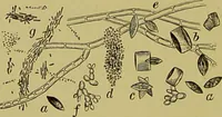 Picture 40 of 61 from Clinical diagnosis : the bacteriological, chemical, and microscopical evidence of disease / By Dr. Rudolf v. Jaksch, ... Translated from the third German edition and enlarged by James Cagney, ... With numerous illustrations (partly in colours). (1893), leaf 262