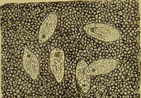 An illustration from Clinical diagnosis : the bacteriological, chemical, and microscopical evidence of disease / By Dr. Rudolf v. Jaksch, ... Translated from the third German edition and enlarged by James Cagney, ... With numerous illustrations (partly in colours). (1893)