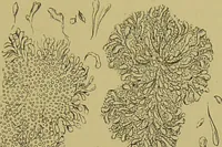 An illustration from Clinical diagnosis : the bacteriological, chemical, and microscopical evidence of disease / By Dr. Rudolf v. Jaksch, ... Translated from the third German edition and enlarged by James Cagney, ... With numerous illustrations (partly in colours). (1893)