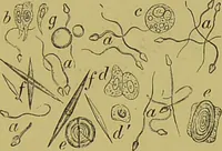 An illustration from Clinical diagnosis : the bacteriological, chemical, and microscopical evidence of disease / By Dr. Rudolf v. Jaksch, ... Translated from the third German edition and enlarged by James Cagney, ... With numerous illustrations (partly in colours). (1893)