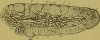 An illustration from Clinical diagnosis : the bacteriological, chemical, and microscopical evidence of disease / By Dr. Rudolf v. Jaksch, ... Translated from the third German edition and enlarged by James Cagney, ... With numerous illustrations (partly in colours). (1893)