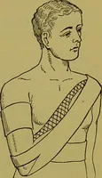An illustration from Clinical diagnosis : the bacteriological, chemical, and microscopical evidence of disease / By Dr. Rudolf v. Jaksch, ... Translated from the third German edition and enlarged by James Cagney, ... With numerous illustrations (partly in colours). (1893)