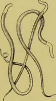 An illustration from Clinical diagnosis : the bacteriological, chemical, and microscopical evidence of disease / By Dr. Rudolf v. Jaksch, ... Translated from the third German edition and enlarged by James Cagney, ... With numerous illustrations (partly in colours). (1893)