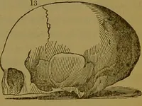 An illustration from Elements of phrenology / By George Combe. (1841)