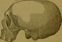 An illustration from Elements of phrenology / By George Combe. (1841)