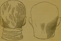 An illustration from Elements of phrenology / By George Combe. (1841)