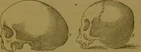 An illustration from Elements of phrenology / By George Combe. (1841)