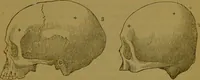 An illustration from Elements of phrenology / By George Combe. (1841)