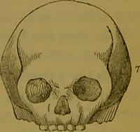 An illustration from Elements of phrenology / By George Combe. (1841)