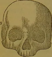 An illustration from Elements of phrenology / By George Combe. (1841)