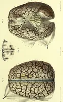An illustration from The nervous system / By Ludovic Hirschfeld, .... Edited in English by Alexander Mason Macdougal,... , with artistically coloured lithographic illustrations, designed by J. B. Léveillé. (1867)