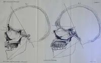 Picture 2 of 13 from Beitraege zur Craniologie / von Th. Landzert. (1867), leaf 43