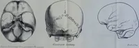Picture 5 of 13 from Beitraege zur Craniologie / von Th. Landzert. (1867), leaf 51