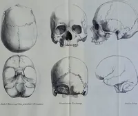 An illustration from Beitraege zur Craniologie / von Th. Landzert. (1867)