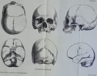 An illustration from Beitraege zur Craniologie / von Th. Landzert. (1867)