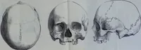 An illustration from Beitraege zur Craniologie / von Th. Landzert. (1867)