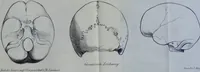 Picture 12 of 13 from Beitraege zur Craniologie / von Th. Landzert. (1867), leaf 61