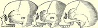 An illustration from Crania Aegyptiaca, or, Observations on Egyptian ethnography derived from anatomy, history and the monuments / by Samuel George Morton. (1844)