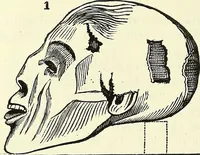 An illustration from Crania Aegyptiaca, or, Observations on Egyptian ethnography derived from anatomy, history and the monuments / by Samuel George Morton. (1844)