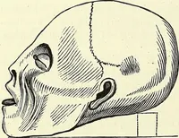 An illustration from Crania Aegyptiaca, or, Observations on Egyptian ethnography derived from anatomy, history and the monuments / by Samuel George Morton. (1844)