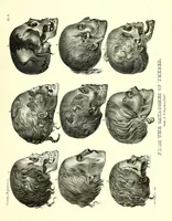 Picture 46 of 49 from Crania Aegyptiaca, or, Observations on Egyptian ethnography derived from anatomy, history and the monuments / by Samuel George Morton. (1844), leaf 97