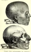 Picture 47 of 49 from Crania Aegyptiaca, or, Observations on Egyptian ethnography derived from anatomy, history and the monuments / by Samuel George Morton. (1844), leaf 99