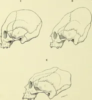 An illustration from Des déformations artificielles du crâne en général de celles de deux crânes macrocéphales trouvés en Hongrie et d'un crâne provenant des temps barbares du meme pays / par Joseph de Lenhossék. (1878)