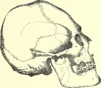 An illustration from Des déformations artificielles du crâne en général de celles de deux crânes macrocéphales trouvés en Hongrie et d'un crâne provenant des temps barbares du meme pays / par Joseph de Lenhossék. (1878)