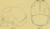 An illustration from Etude sur les cranes Boughis et Dayaks du Muséums d'histoire du naturelle / par le Dr. Montano. (1878)
