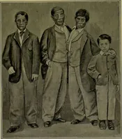 An illustration from Anomalies and curiosities of medicine : being an encyclopedic collection of rare and extraordinary cases, and of the most striking instances of abnormality in all branches of medicine and surgery, derived from an exhaustive research of medical literature from its origin to the present day / abstracted, classified, annotated, and indexed, by George M. Gould and Walter L. Pyle ; with 295 illustrations in the text, and 12 half-tone and colored plates. (1897)