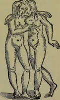 Picture 19 of 111 from Anomalies and curiosities of medicine : being an encyclopedic collection of rare and extraordinary cases, and of the most striking instances of abnormality in all branches of medicine and surgery, derived from an exhaustive research of medical literature from its origin to the present day / abstracted, classified, annotated, and indexed, by George M. Gould and Walter L. Pyle ; with 295 illustrations in the text, and 12 half-tone and colored plates. (1897), leaf 179