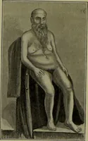 Picture 31 of 111 from Anomalies and curiosities of medicine : being an encyclopedic collection of rare and extraordinary cases, and of the most striking instances of abnormality in all branches of medicine and surgery, derived from an exhaustive research of medical literature from its origin to the present day / abstracted, classified, annotated, and indexed, by George M. Gould and Walter L. Pyle ; with 295 illustrations in the text, and 12 half-tone and colored plates. (1897), leaf 216