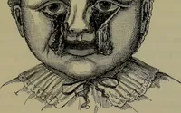 An illustration from Anomalies and curiosities of medicine : being an encyclopedic collection of rare and extraordinary cases, and of the most striking instances of abnormality in all branches of medicine and surgery, derived from an exhaustive research of medical literature from its origin to the present day / abstracted, classified, annotated, and indexed, by George M. Gould and Walter L. Pyle ; with 295 illustrations in the text, and 12 half-tone and colored plates. (1897)