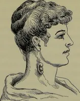 An illustration from Anomalies and curiosities of medicine : being an encyclopedic collection of rare and extraordinary cases, and of the most striking instances of abnormality in all branches of medicine and surgery, derived from an exhaustive research of medical literature from its origin to the present day / abstracted, classified, annotated, and indexed, by George M. Gould and Walter L. Pyle ; with 295 illustrations in the text, and 12 half-tone and colored plates. (1897)