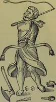An illustration from Anomalies and curiosities of medicine : being an encyclopedic collection of rare and extraordinary cases, and of the most striking instances of abnormality in all branches of medicine and surgery, derived from an exhaustive research of medical literature from its origin to the present day / abstracted, classified, annotated, and indexed, by George M. Gould and Walter L. Pyle ; with 295 illustrations in the text, and 12 half-tone and colored plates. (1897)