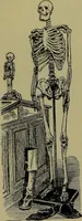 An illustration from Anomalies and curiosities of medicine : being an encyclopedic collection of rare and extraordinary cases, and of the most striking instances of abnormality in all branches of medicine and surgery, derived from an exhaustive research of medical literature from its origin to the present day / abstracted, classified, annotated, and indexed, by George M. Gould and Walter L. Pyle ; with 295 illustrations in the text, and 12 half-tone and colored plates. (1897)