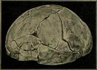 Picture 81 of 111 from Anomalies and curiosities of medicine : being an encyclopedic collection of rare and extraordinary cases, and of the most striking instances of abnormality in all branches of medicine and surgery, derived from an exhaustive research of medical literature from its origin to the present day / abstracted, classified, annotated, and indexed, by George M. Gould and Walter L. Pyle ; with 295 illustrations in the text, and 12 half-tone and colored plates. (1897), leaf 570