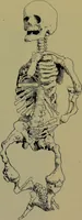 An illustration from Anomalies and curiosities of medicine : being an encyclopedic collection of rare and extraordinary cases, and of the most striking instances of abnormality in all branches of medicine and surgery, derived from an exhaustive research of medical literature from its origin to the present day / abstracted, classified, annotated, and indexed, by George M. Gould and Walter L. Pyle ; with 295 illustrations in the text, and 12 half-tone and colored plates. (1897)