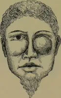 An illustration from Anomalies and curiosities of medicine : being an encyclopedic collection of rare and extraordinary cases, and of the most striking instances of abnormality in all branches of medicine and surgery, derived from an exhaustive research of medical literature from its origin to the present day / abstracted, classified, annotated, and indexed, by George M. Gould and Walter L. Pyle ; with 295 illustrations in the text, and 12 half-tone and colored plates. (1897)
