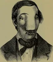 An illustration from Anomalies and curiosities of medicine : being an encyclopedic collection of rare and extraordinary cases, and of the most striking instances of abnormality in all branches of medicine and surgery, derived from an exhaustive research of medical literature from its origin to the present day / abstracted, classified, annotated, and indexed, by George M. Gould and Walter L. Pyle ; with 295 illustrations in the text, and 12 half-tone and colored plates. (1897)