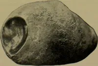 Picture 103 of 111 from Anomalies and curiosities of medicine : being an encyclopedic collection of rare and extraordinary cases, and of the most striking instances of abnormality in all branches of medicine and surgery, derived from an exhaustive research of medical literature from its origin to the present day / abstracted, classified, annotated, and indexed, by George M. Gould and Walter L. Pyle ; with 295 illustrations in the text, and 12 half-tone and colored plates. (1897), leaf 803