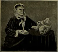An illustration from Anomalies and curiosities of medicine : being an encyclopedic collection of rare and extraordinary cases, and of the most striking instances of abnormality in all branches of medicine and surgery, derived from an exhaustive research of medical literature from its origin to the present day / abstracted, classified, annotated, and indexed, by George M. Gould and Walter L. Pyle ; with 295 illustrations in the text, and 12 half-tone and colored plates. (1897)