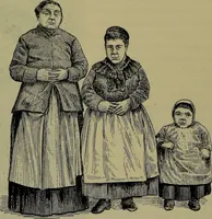 An illustration from Anomalies and curiosities of medicine : being an encyclopedic collection of rare and extraordinary cases, and of the most striking instances of abnormality in all branches of medicine and surgery, derived from an exhaustive research of medical literature from its origin to the present day / abstracted, classified, annotated, and indexed, by George M. Gould and Walter L. Pyle ; with 295 illustrations in the text, and 12 half-tone and colored plates. (1897)
