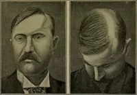 Picture 111 of 111 from Anomalies and curiosities of medicine : being an encyclopedic collection of rare and extraordinary cases, and of the most striking instances of abnormality in all branches of medicine and surgery, derived from an exhaustive research of medical literature from its origin to the present day / abstracted, classified, annotated, and indexed, by George M. Gould and Walter L. Pyle ; with 295 illustrations in the text, and 12 half-tone and colored plates. (1897), leaf 873