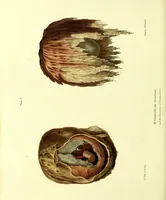 An illustration from Graphic illustrations of abortion and the diseases of menstruation. Consisting of twelve plates from drawings engraved on stone, and coloured by Mr. J. Perry, and two copperplates from the Philosophical transactions, coloured by the same artist. The whole representing forty-five specimens of aborted ova and adventitious productions of the uterus, with preliminary observations, explanations of the figures, and remarks, anatomical physiological / by A.B. Granville. (1834)