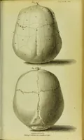 Picture 4 of 21 from Illustrations of phrenology : with engravings / by Sir G. S. Mackenzie. (1820), leaf 299