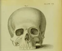 Picture 10 of 21 from Illustrations of phrenology : with engravings / by Sir G. S. Mackenzie. (1820), leaf 307