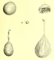 An illustration from Illustrations of the diseases of the breast ... Part 1 / by Sir Astley Cooper. (1829)